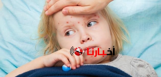 موعد الحملة القومية للتطعيم ضد الحصبة