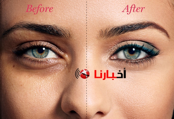 وصفة لعلاج الهالات السوداء